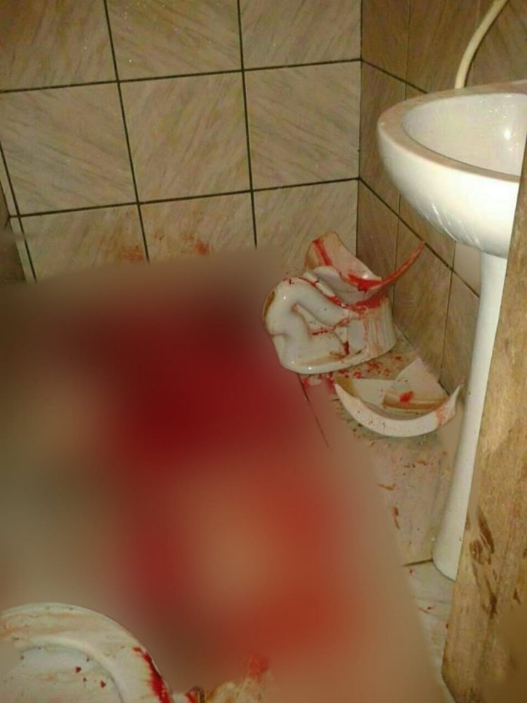 Mulher morre ao se ferir gravemente após subir em vaso sanitário e ele quebrar